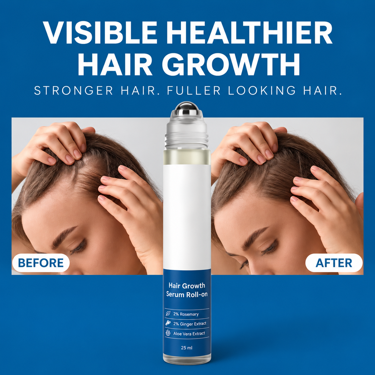 🎉BUY 1 GET 1 FREE🎉Hair Growth Roll on Serum