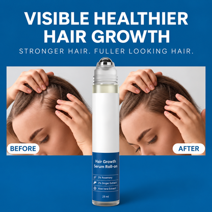 🎉BUY 1 GET 1 FREE🎉Hair Growth Roll on Serum
