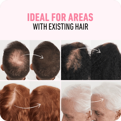 ✨ Nexisify Hair Thickening Fibers — Fuller-Looking Hair in Seconds