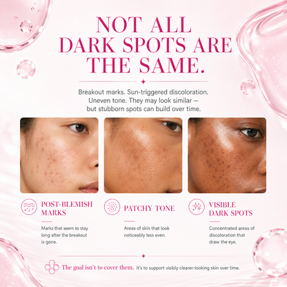 ✨ Nexisify 7% Arbutin + 4% Tranexamic Acid Dark Spot Cream