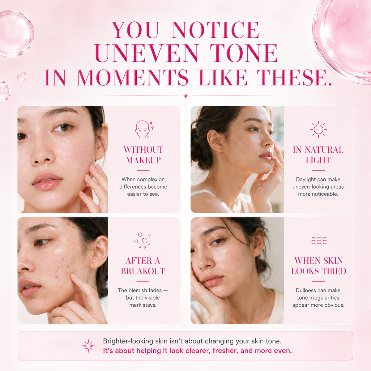 ✨ Nexisify 7% Arbutin + 4% Tranexamic Acid Dark Spot Cream