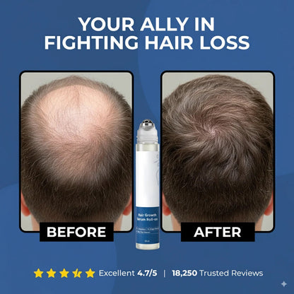 🎉BUY 1 GET 1 FREE🎉Hair Growth Roll on Serum