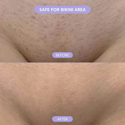 Divifit Bikini Pain-Free Hair Removal Cream for Sensitive Skin