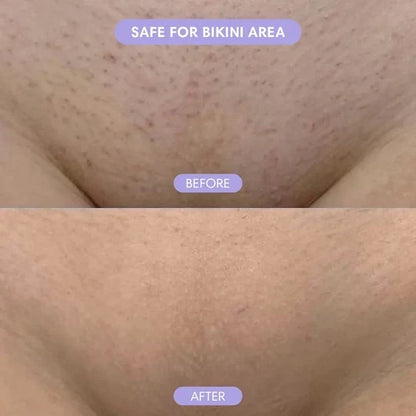 Divifit Bikini Pain-Free Hair Removal Cream for Sensitive Skin